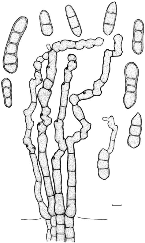Cladosporium Echinulatum M 0057503 Isotype Of Heteros Open I