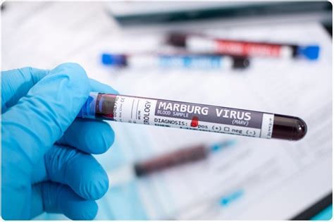 How is marburg virus transmitted? Estrutura e transmissão do vírus de Marburg