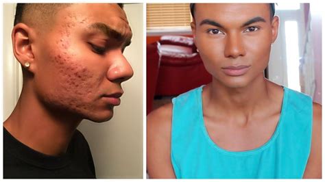 how to cover up really bad acne what can i do makeup for men bad acne acne male makeup