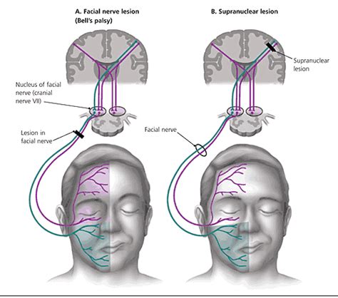 Pin En Neuro