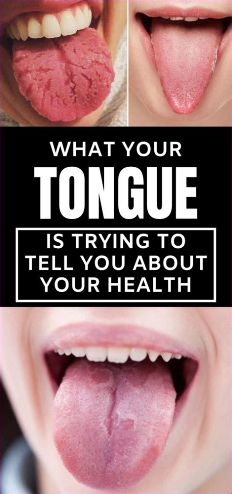 What Your Tongue Is Trying To Tell You About Your Health Healthy