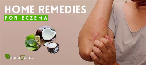9 Home Remedies For Skin Rashes And Itching That Work [naturally]
