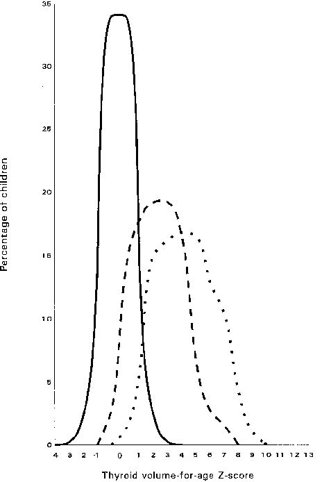 comparing distributions of thyroid volume for age z scores of two download scientific diagram