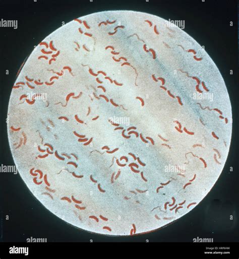 Cholera Bacterium Vibrio Cholerae Fotografías E Imágenes De Alta