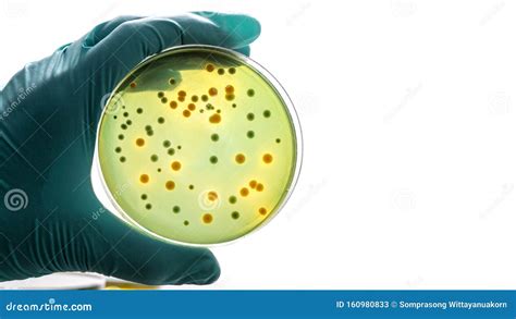 Mano Guante Sosteniendo Un Cultivo De La Bacteria De La Placa Petri