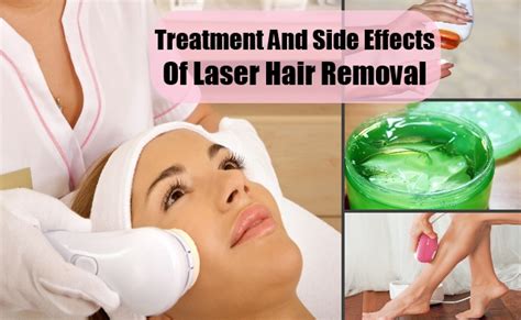 Laser hair removal prices are pretty steep. Treatment And Side Effects Of Laser Hair Removal - The ...