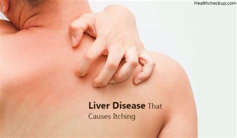 Liver Disease That Cause Itching