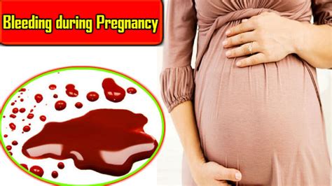 Bleeding During Pregnancy Garbhavastha Ki Mukhya Pareshani