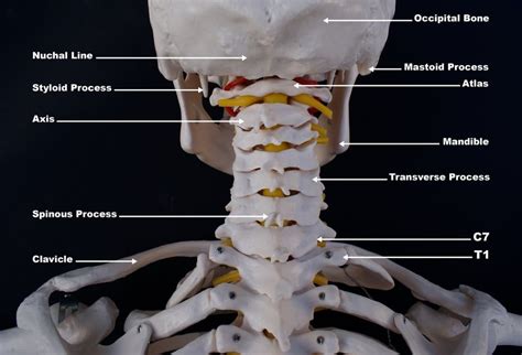 Chronic Neck Pain Common Causes And Reasons