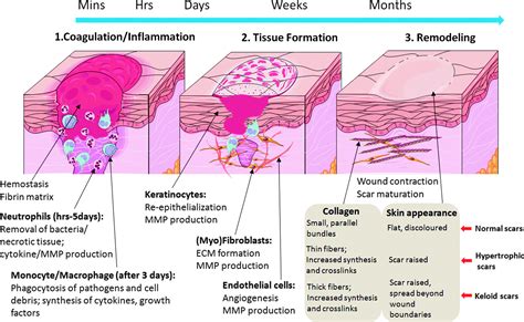 Extracellular Matrix Reorganization During Wound Healing And Its Impact