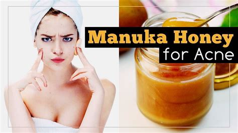 manuka honey for acne how to use it youtube
