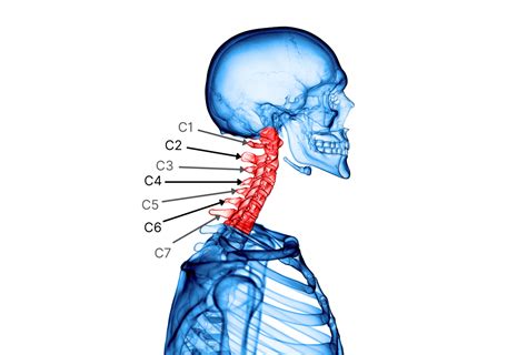 Neck Pain Types And Causes Spinal Backrack