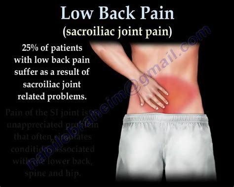 Sacroiliac Joint Pain And Dysfunction Everything You Need To Know