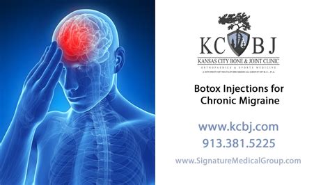 Botox Injections For Treatment Of Chronic Migraine Youtube