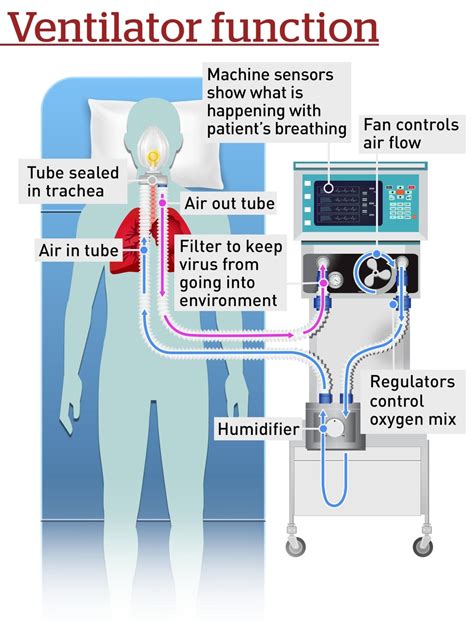 What Is A Ventilator And Who Gets One If Covid 19 Turns Catastrophic In