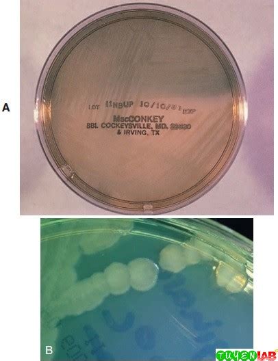 Microbiology Atlas Of Nonfermenting And Miscellaneous Gram Negative
