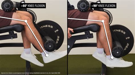 Leg Extensions After Acl Reconstruction E3 Rehab