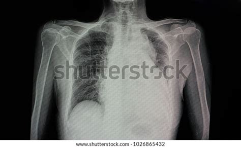 Pericadial G Rseli Stok Foto Raflar Ve Vekt Rler Shutterstock