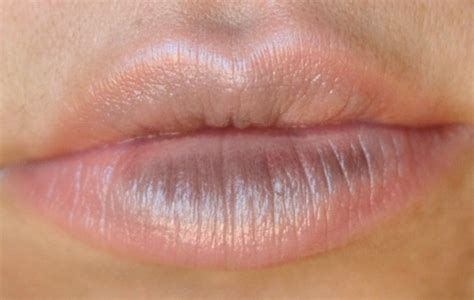 How To Get Rid Of Skin Discoloration On Your Upper Lip Heidi Salon