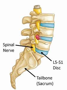 Diagram Spine L5s1