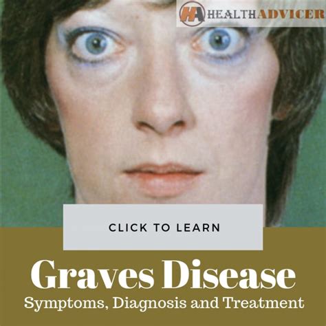 Graves Disease Causes Picture Symptoms And Treatment