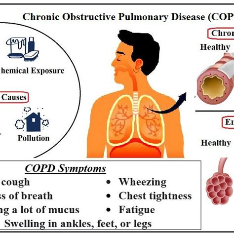 Chronic Obstructive Pulmonary Disease Download Scientific Diagram