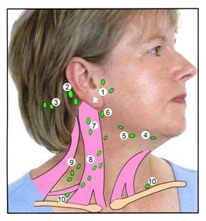 Pin By Peter Sedesse On Disease And Symptoms Swollen Lymph Nodes