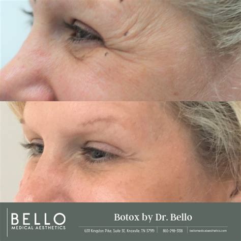 About Us Bello Medical Aesthetics