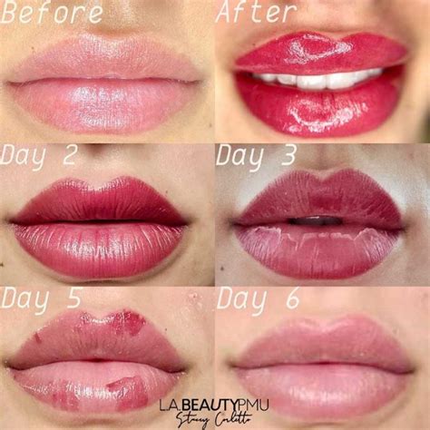Lip Blush Aftercare How To Get The Best Lip Tattoo Results