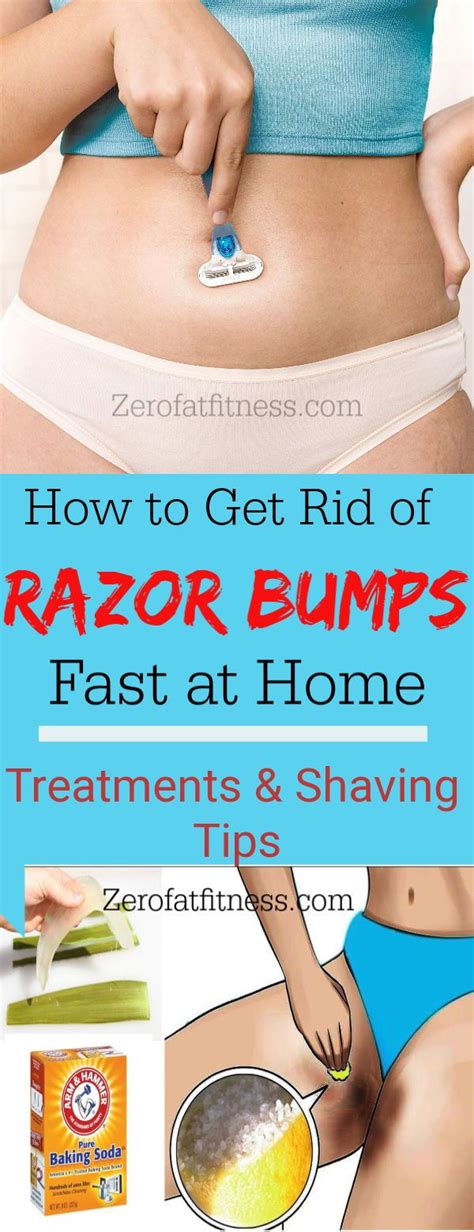 How To Get Relief From Razor Burn Home And Garden Reference
