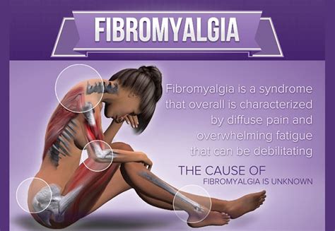 Symptoms Of Fibromyalgia Anyone With Muscle Pain Should Read This