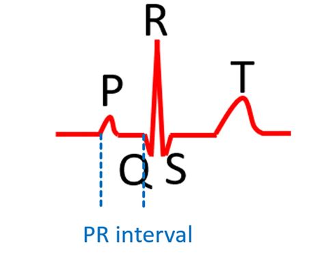 What Are The Normal Values For Ecg Measurements All About Heart And