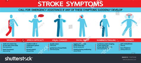 Stroke Symptoms Infographic Icon Illustrations Stock Vector Royalty