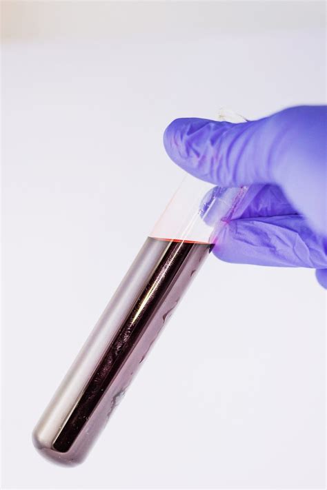 Blood Culture Contaminationits A Big Deal Division Of Infectious