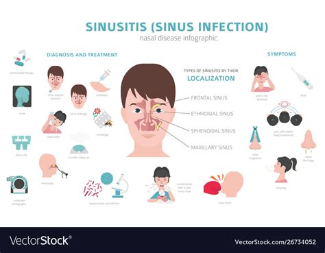 Nasal Diseases Sinusitis Sinus Infection Vector Image