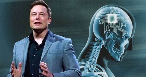 Elon Musk Plans Human Trials For Brain Chip In Six Months