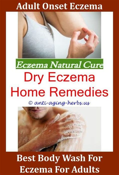 Pin On Eczema Routine