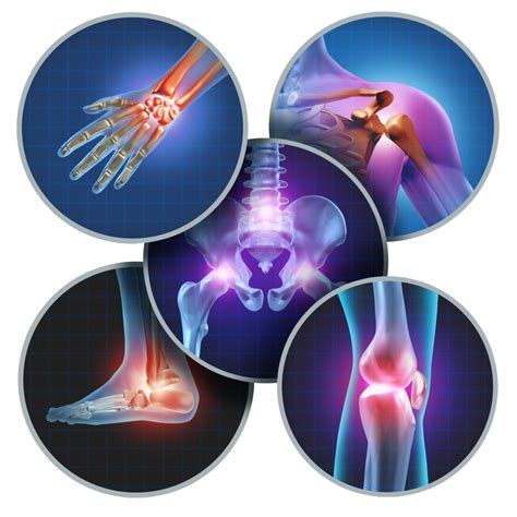 What You Need To Know About Osteoarthritis Prevention And Treatment
