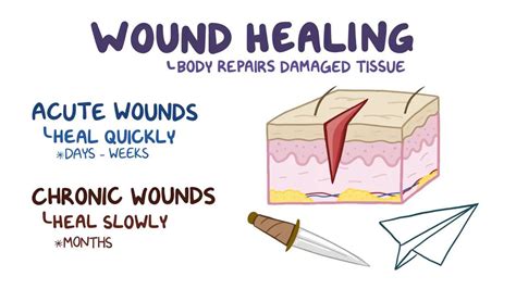 Wound Healing Video Anatomy Definition And Function Osmosis