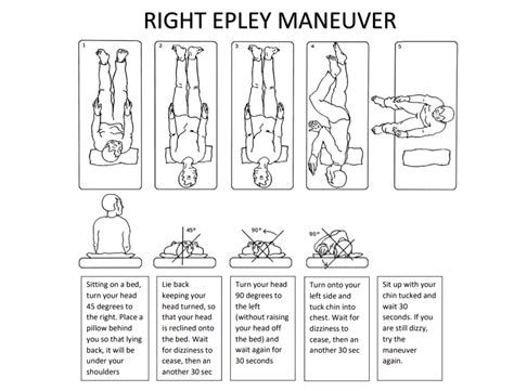 √ Epleys Maneuver Modified Epleys Left It Is Also Known As The