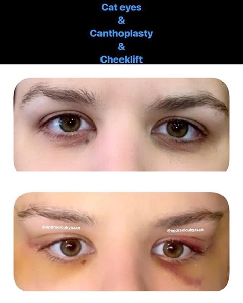 The botched doctors don't think it's safe for sabrina to keep getting cat eye surgery. New #The #10 #Best #Eye #Makeup #Ideas #Today #(with # ...