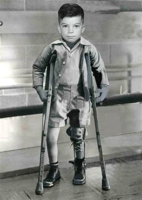 Pin By Dianne Dych On Polio 3 Polio Medical Photos Leg Braces