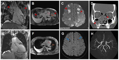 Frontiers Case Report An Unusual Presentation Of Cardiovascular