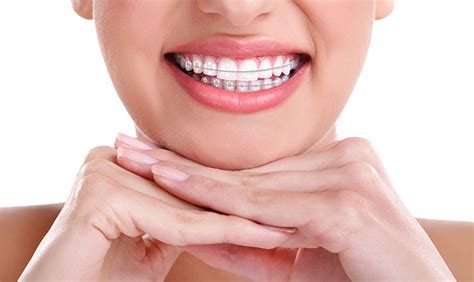 Orthodontist Best Orthodontist Dr Jamilian Orthodontic Board Of Europe