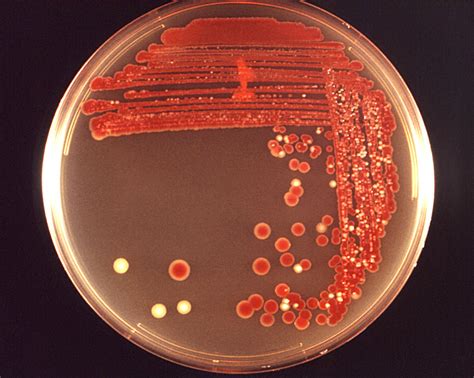 Public Domain Picture This Inoculated Blood Agar Base Plate