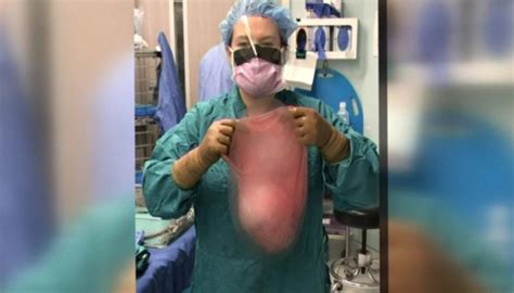Pregnant Woman Has Huge Cyst Removed Newshub