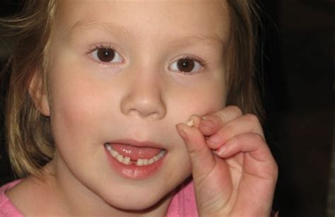 There are a few reasons why a person may have a loose tooth. How to Pull a Loose Tooth