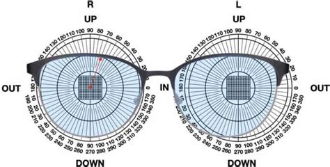 How To Fit A Fresnel Prism Foil To Your Glasses