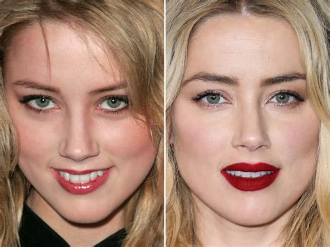 Amber Heard Nose Job Before And After