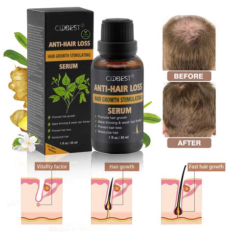 V Care Hair Growth Serum Thymuskin Classic Hair Care Peptides